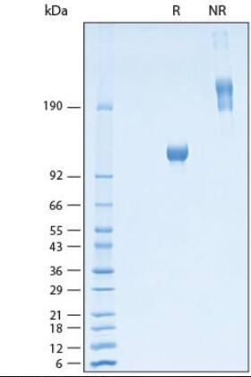 2 μg/lane of Recombinant Rat Osteoactivin/GPNMB Fc Chimera Protein was resolved with SDS-PAGE under reducing (R) and non-reducing (NR) conditions and visualized by Coomassie Blue staining, showing bands at 100-122 kDa and 200-240 kDa, respectively.